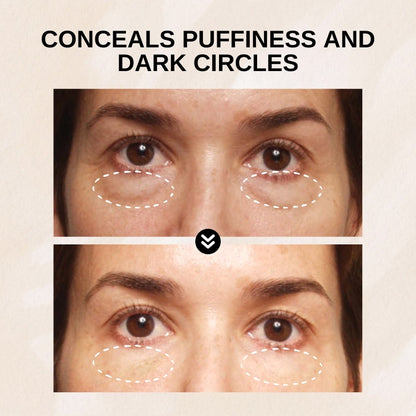 Radiance Undereye Contour Cream